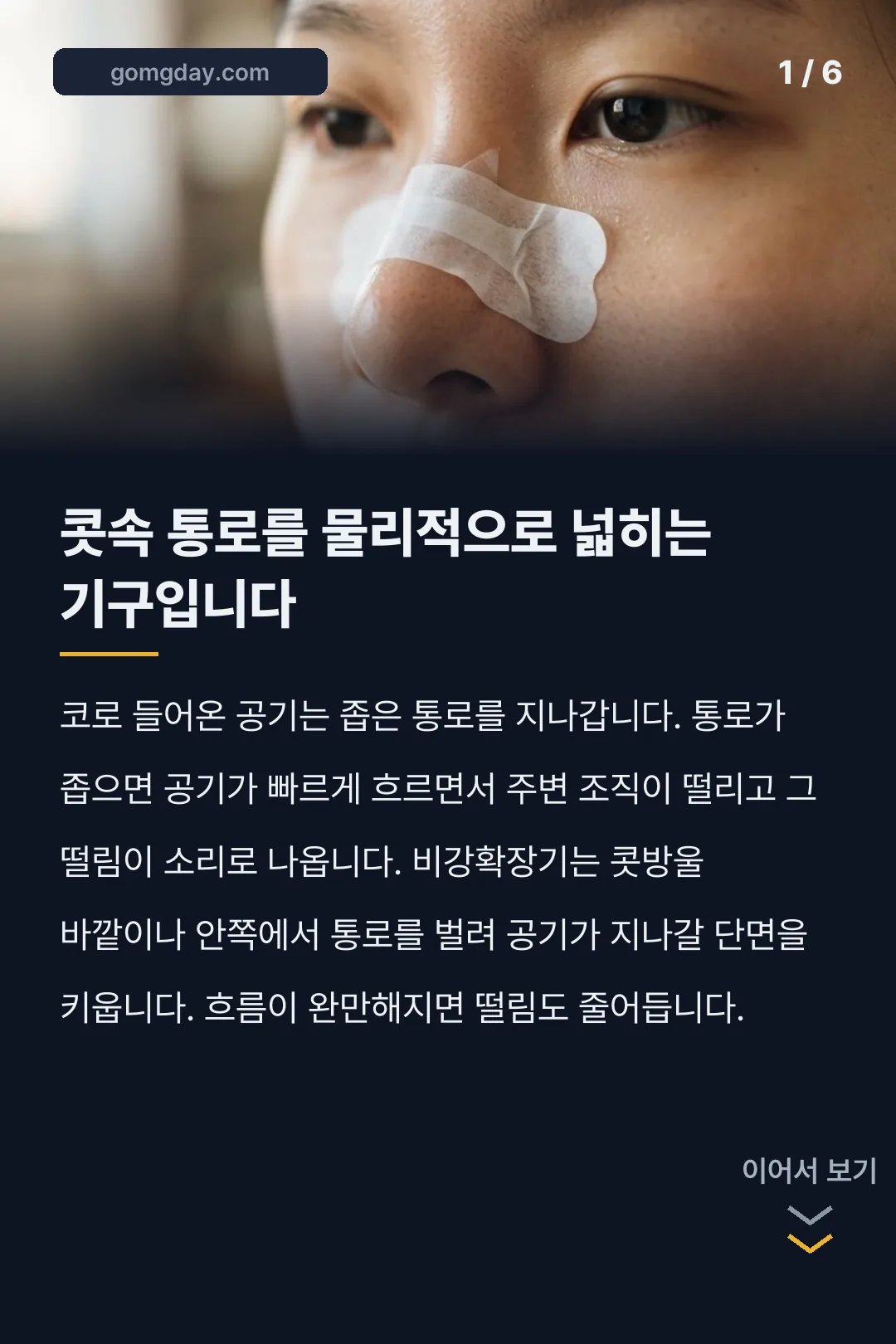 에어링 비강확장기 카드뉴스 1