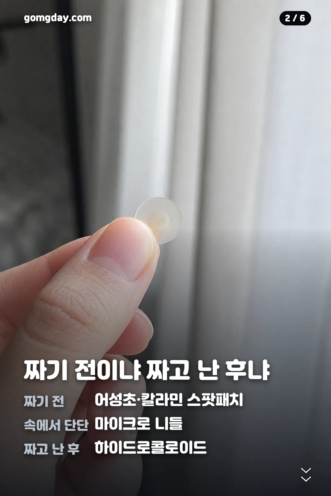 다이소 여드름 패치 카드뉴스 2
