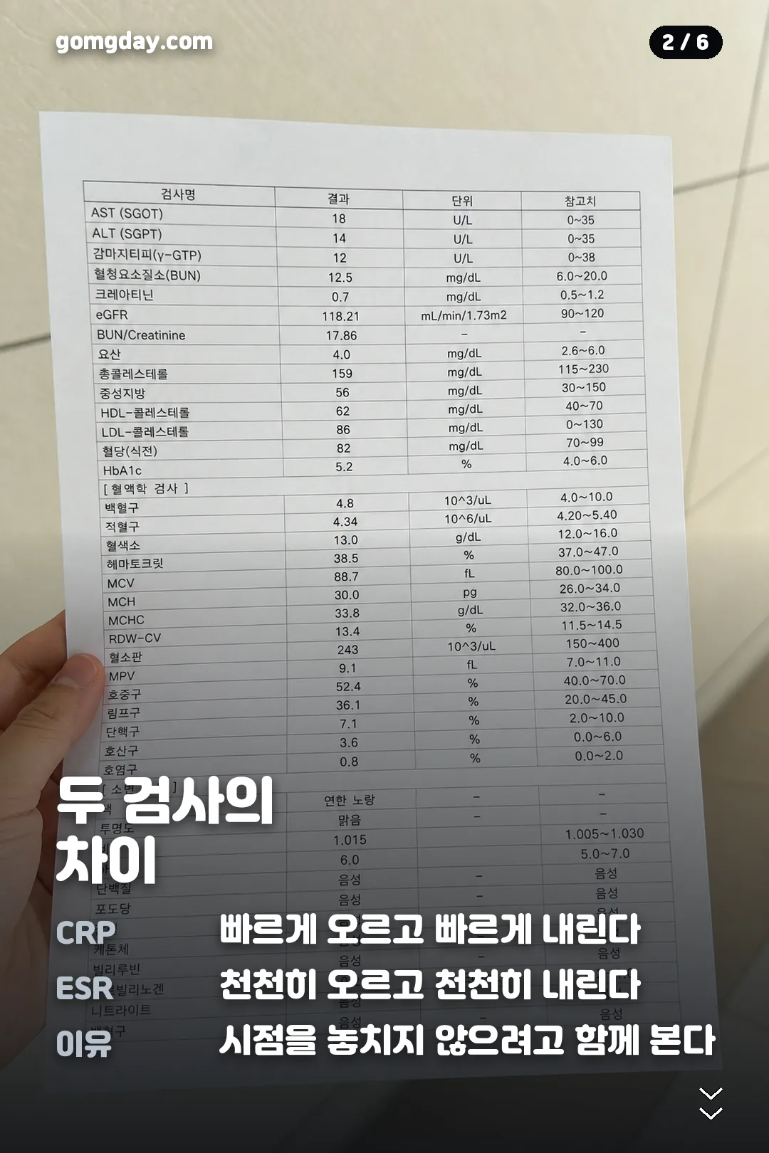 쥬얼리 이지현 염증수치 카드뉴스 2