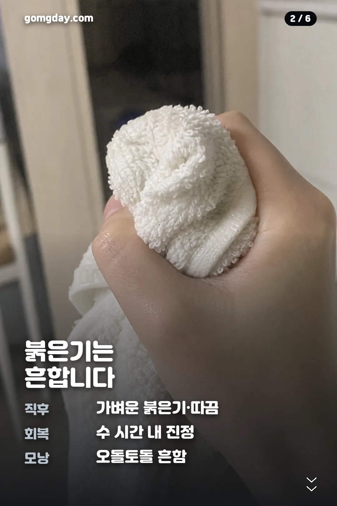 조브스 제모기 부작용 카드뉴스 2