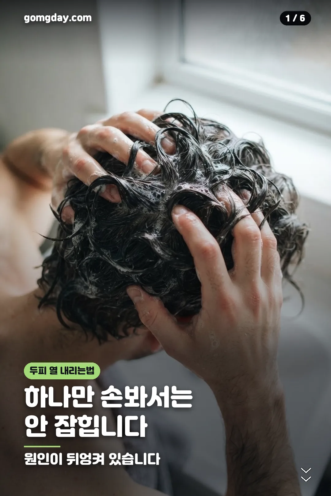 두피 열 내리는법 카드뉴스 1