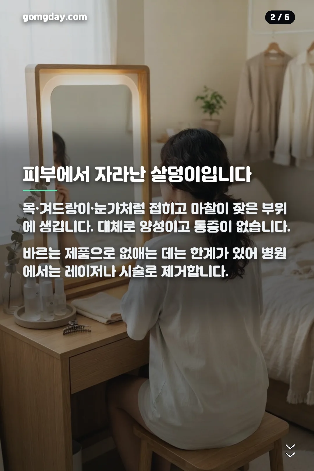 쥐젖 제거 크림 카드뉴스 2