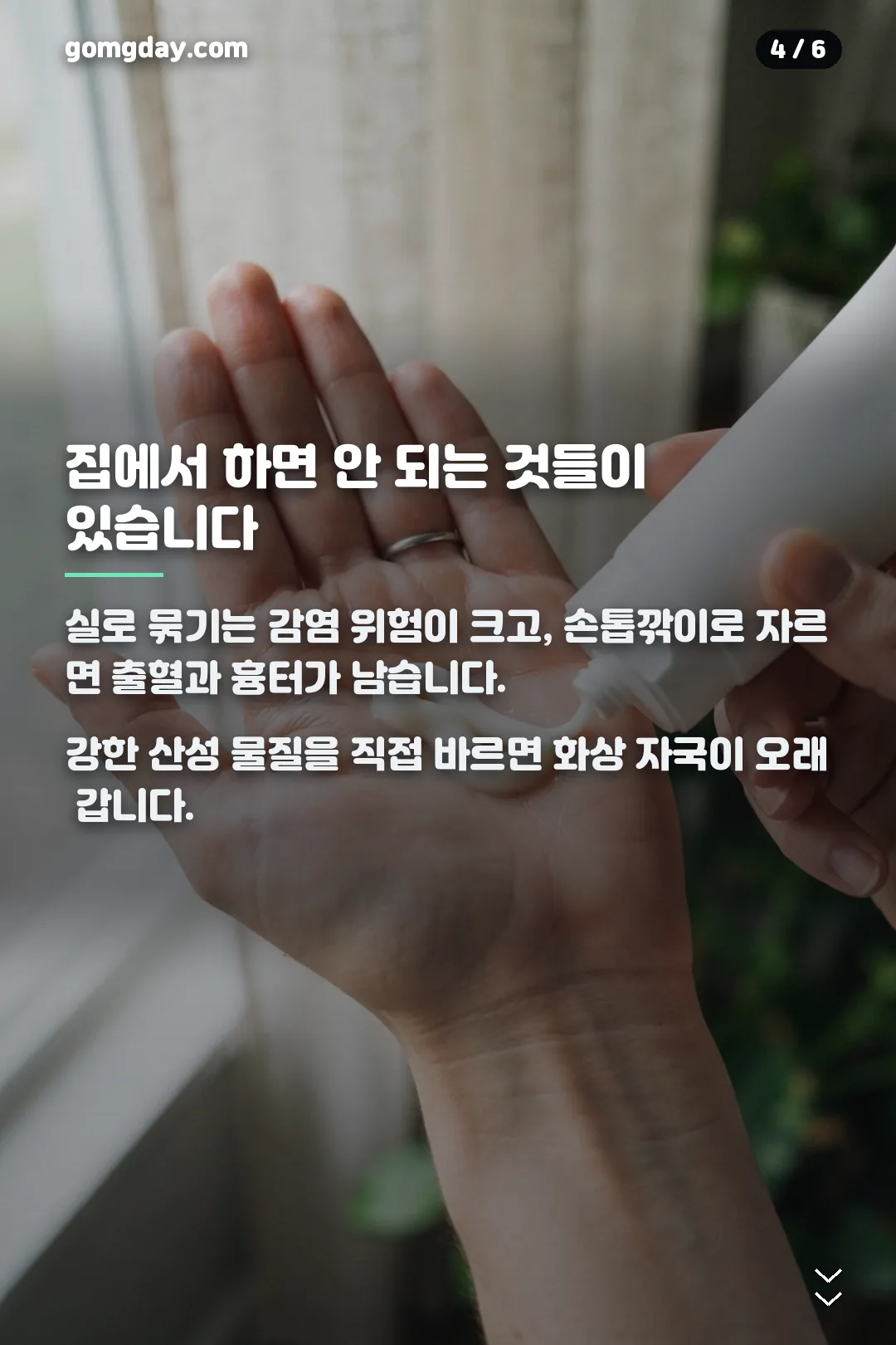 쥐젖 제거 크림 카드뉴스 4